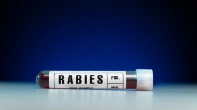 Disnakeswan Subang Gelar Vaksinasi Rabies Gratis untuk Hewan Peliharaan, Catat Jadwalnya