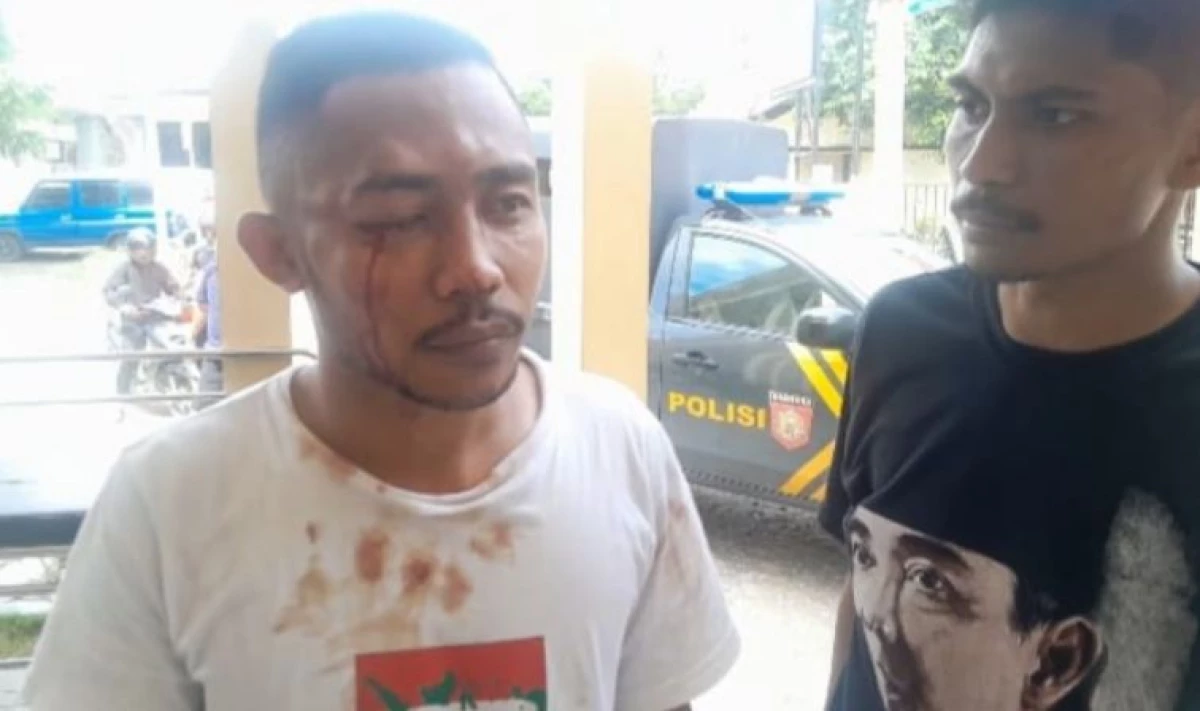 BEMNUS Jawa Barat Mengutuk Keras Tindakan Brutal Aparat terhadap BEMNUS NTT di Depan Pangadilan Negeri Kupang