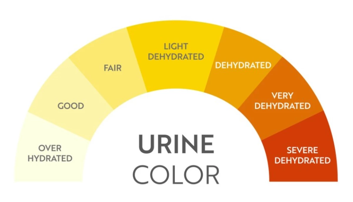 Berbagai Macam Warna Urine dan Tandanya. (Sumber Gambar: adultpediatricuro.com)