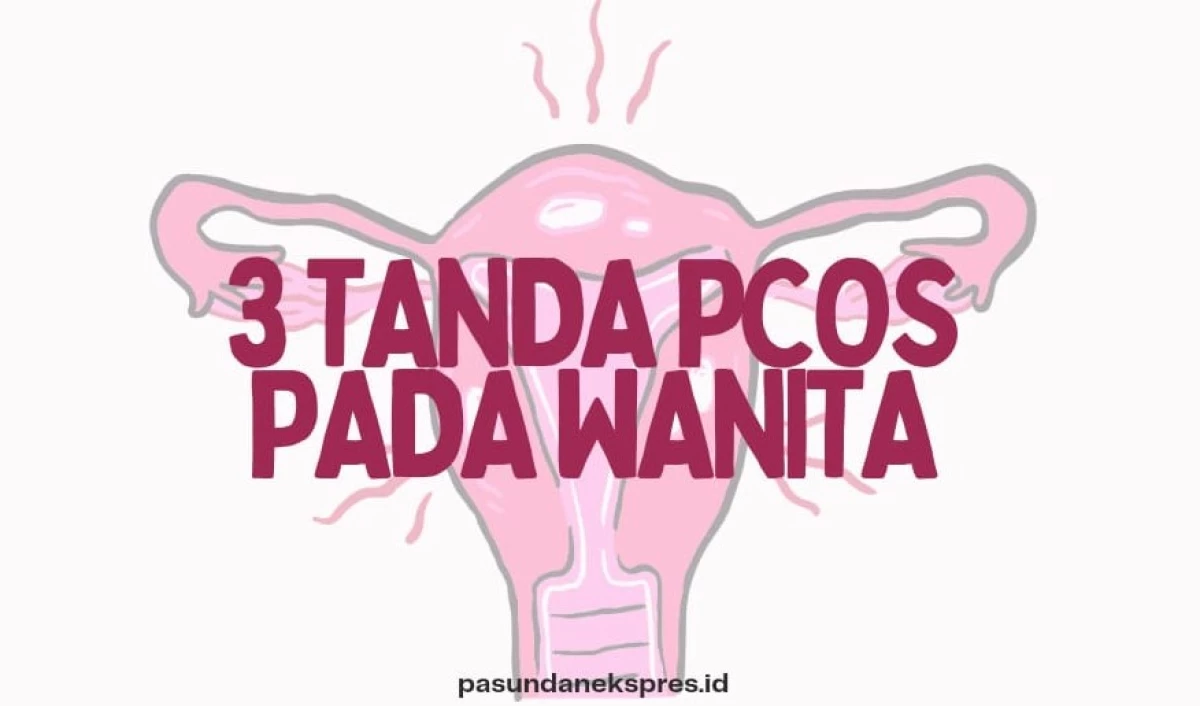 3 Tanda PCOS Pada Wanita. (Sumber Ilustrasi: Pasundan Ekspres/Canva)
