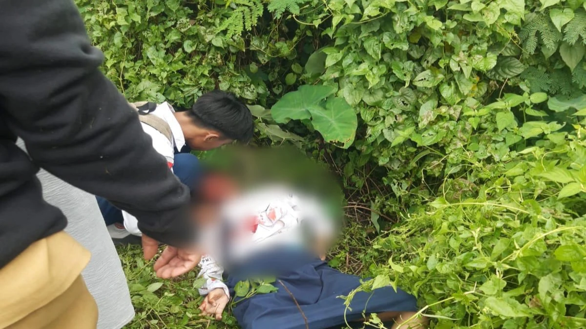 Pelajar SMP di Purwakarta Terserempet Kereta, Dirawat Intensif di RS Bayu Asih